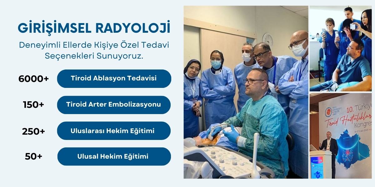 Antalya Girişimsel Radyoloji, Ameliyatsız Tiroid Nodül Tedavisi, Doktorları, Doç. Dr. Bülent Çekiç