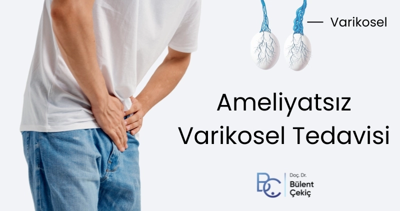 Ameliyatsız Varikosel Tedavisi Fiyatları Ameliyatsız Varikosel Tedavisi Fiyatları Antalya, İstanbul, Ankara
