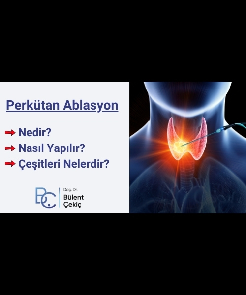 Perkütan Ablasyon Nedir? Ablatif Tedavi