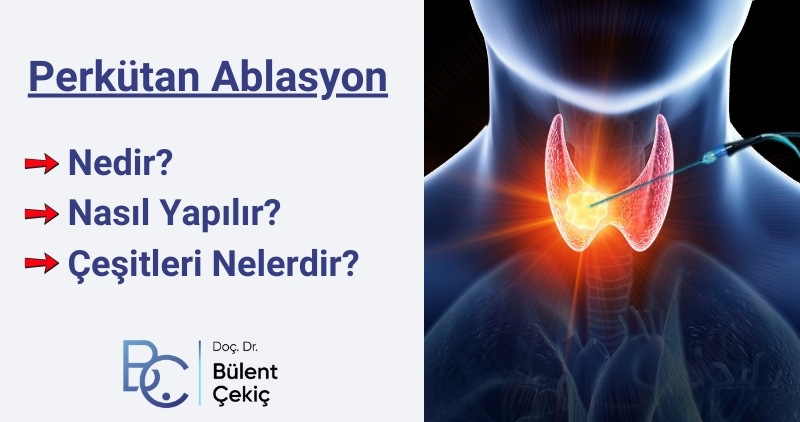 Perkütan Ablasyon Nedir? Nasıl Yapılır? Ablatif Tedavi, Antalya, Muratpaşa, İstanbul, Ankara