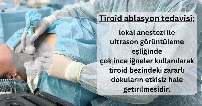 Tiroid Ablasyon Tedavisi Nedir?, Fiyatları Antalya, Muratpaşa, İstanbul, Ankara