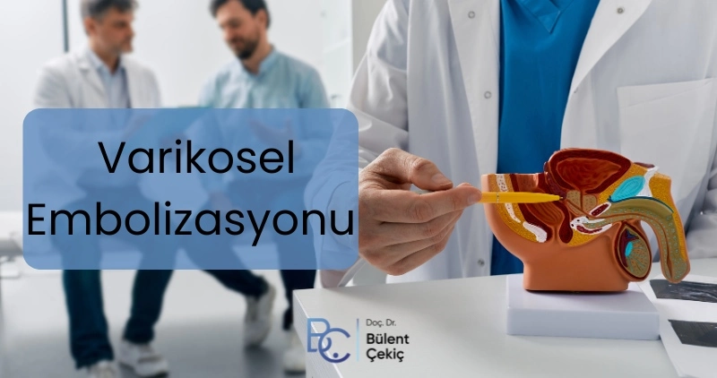 Varikosel Embolizasyonu Varikosel Embolizasyonu Fiyatları Antalya, İstanbul, Ankara